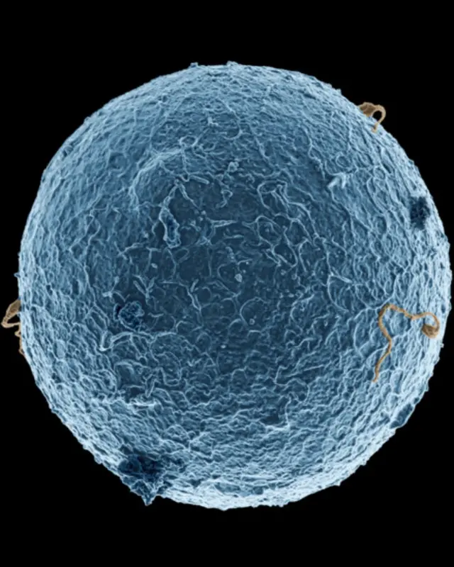 سه اسپرم در تلاش برای نفوذ به تخمک