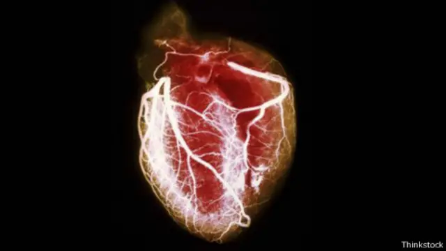 直到最近10年，醫生才完全承認精神緊張的確會引發的心力衰竭(圖片來源：SPL)