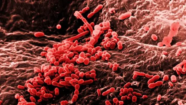 Derimizde bile çok sayıda bakteri vardır.