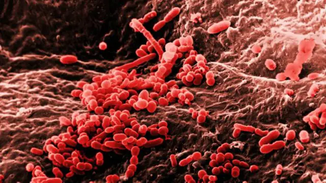 Bakteri ada di mana saja termasuk kulit Anda. (Kredit: David M. Phillips/Science Photo Library)