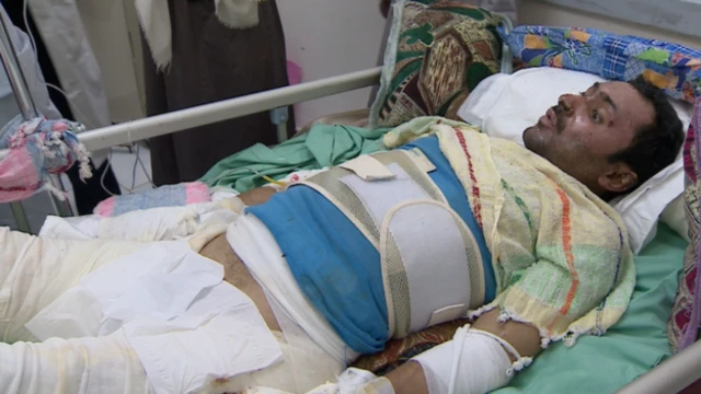 Abdel Bari Omar, víctima de la guerra en Yemen