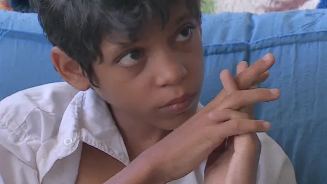 Mohammed, víctima de la guerra en Yemen