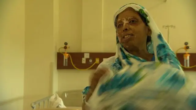 Значна частина пацієнтів, що звертаються до Interplast UK у Індії, – жертви кислотних атак