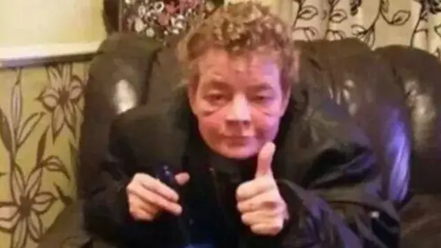 怀特森身上100多处创伤，80多处在脸部。殴打从傍晚一直持续到凌晨4点。