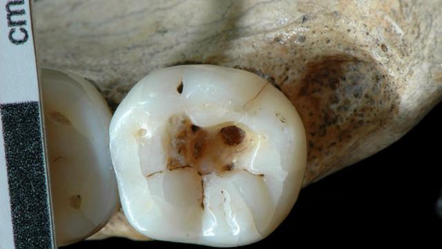 Чудовищная стоматология древнего мира