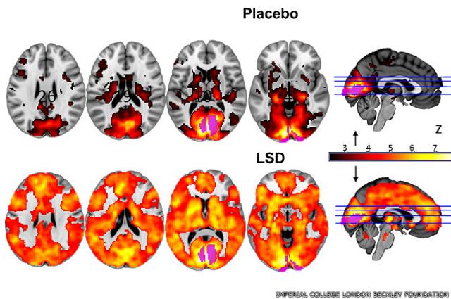 Escáner de cerebros que recibieron placebos, arriba, y LSD, abajo