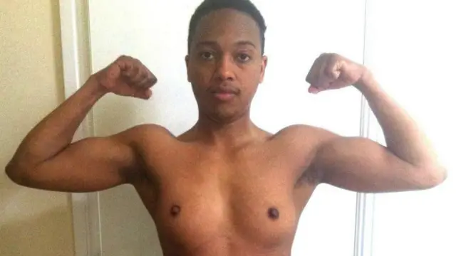 Para Romario la operación era muy importante estéticamente.