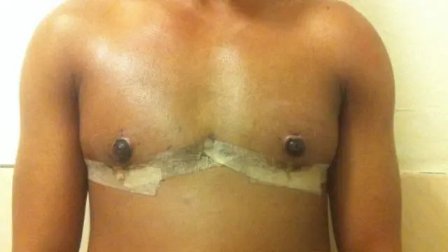 La mayor preocupación de Romario es que los pezones no estuvieran equilibrados.