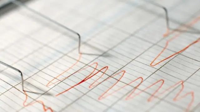 Poligraf testi çoğu ülkede mahkemede delil olarak kullanılamıyor.