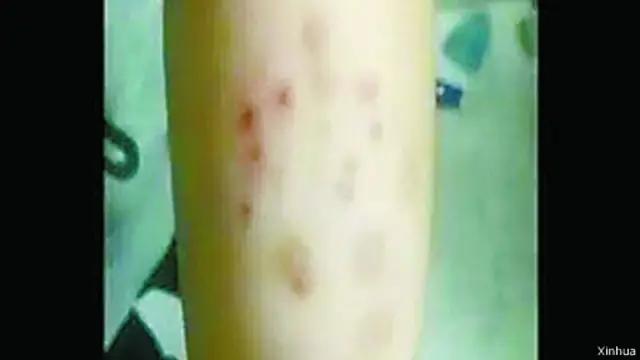 常州外国语学校因选址紧邻“毒地”,导致数百名学生患病一事持续发酵