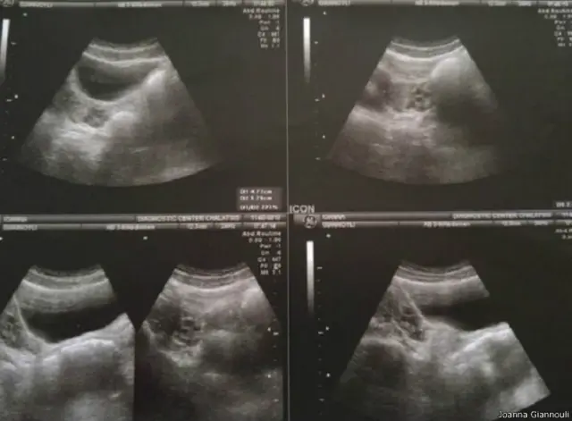 Lezbiyenlar yalab va anal Guruh porno