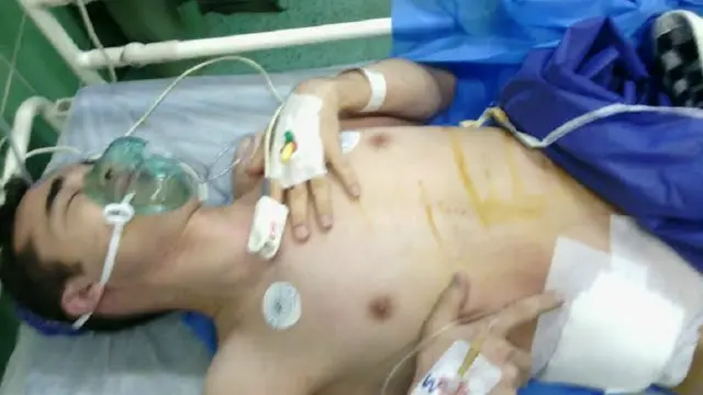 امید کوکبی بعد از عمل خارج کردن کلیه 