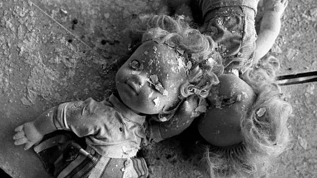 Masih ada bayi yang terlahir dengan kondisi cacat akibat radiasi nuklir.