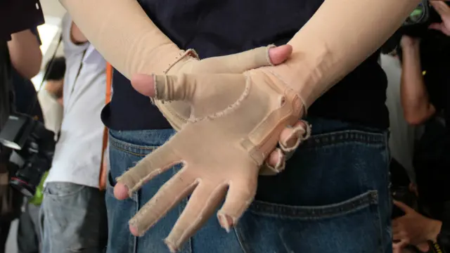 一名穿上紧身衣的八仙尘爆幸存者在台北士林地方法院外参加请愿（26/4/2016）