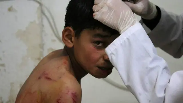 داریا میں گذشتہ تین برسوں سے کوئی امداد نہیں پہنچی ہے