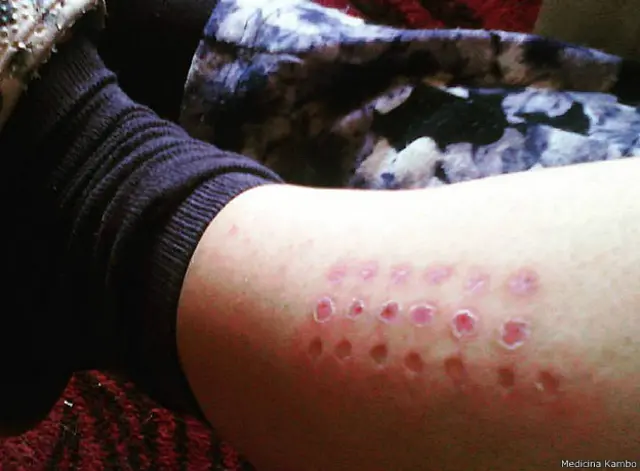 Númerojogo sena onlinepontosjogo sena onlineaplicação dependejogo sena onlinesexo, idade e complexidade do caso