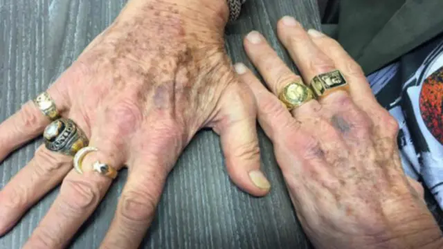 奥尔德林手指上五枚粗重的戒指反映了他本人的辉煌履历。（图片来源：Sue Nelson）