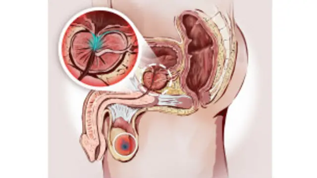 Es un órgano glándular del aparato reproductor masculino.