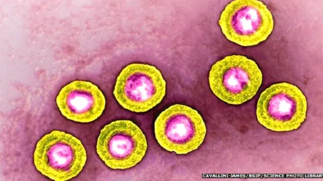 Manusia kemungkinan besar menyebarkan virus herpes ke Neanderthal.