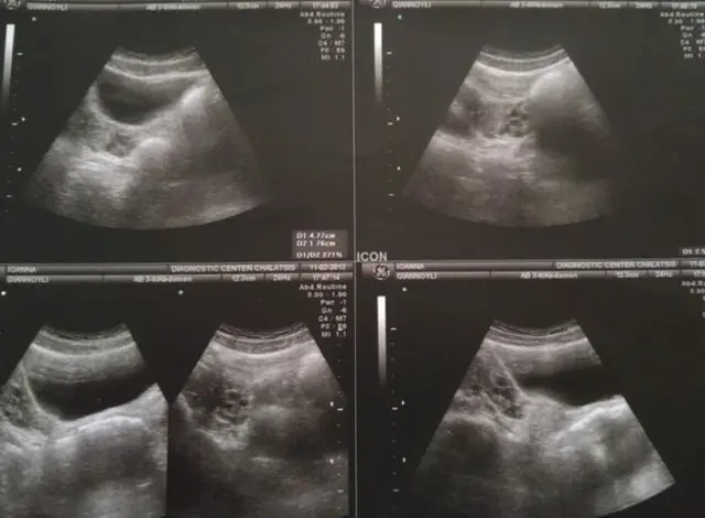 عکسهایی که در سال ۲۰۱۳ از بخش تحتانی شکم جوآنا گرفته شده بود