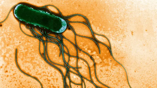 Một con vi khuẩn Salmonella. Ảnh:USDA/Science Source/Science Photo Library