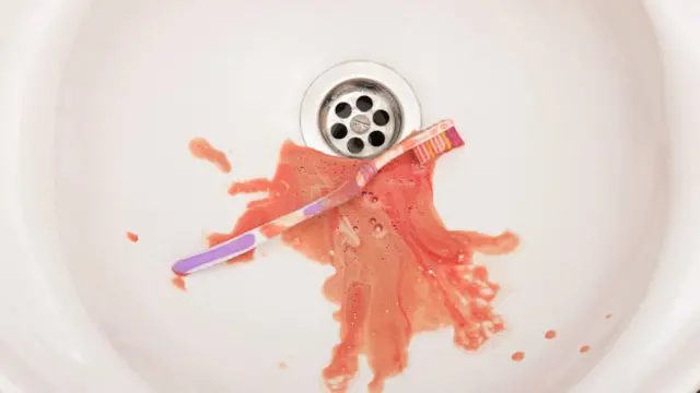 ¿Te sangran las encías al cepillarte los dientes? Señal de que algo no va bien.