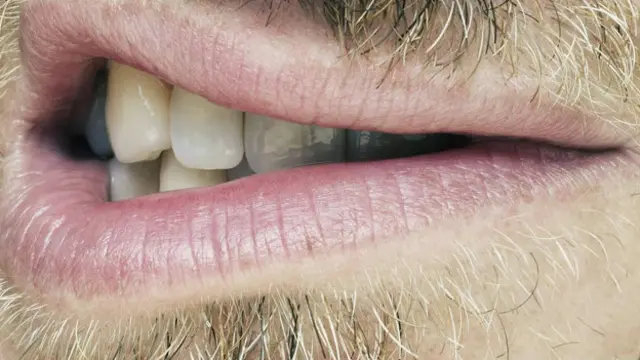 Жиденькая бороденка