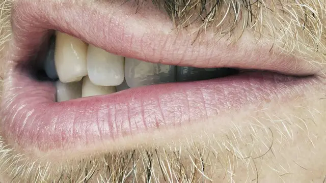 Brewok tak secara konsisten menambah daya tarik, tapi mereka yang menumbuhkannya dianggap lebih dominan.