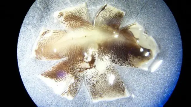 Las retinas fueron estudiadas con microscopios para analizar sus características especiales.