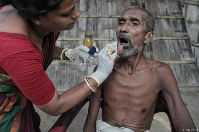 kerala_palliative_care