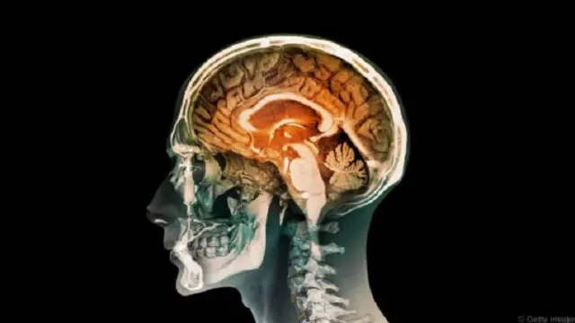 من السهل التقليل من شأن تأثير قوة الدماغ على الجسد 