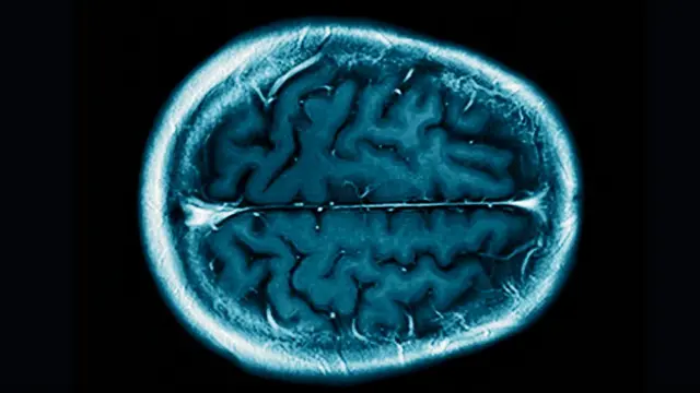 Метод сцинтиграфии головного мозга использовался и раньше для наблюдения за его деятельностью, но не для двустороннего общения