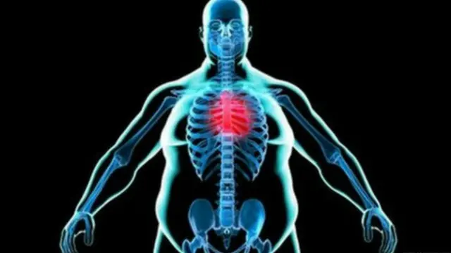 Современная медицина научилась гораздо эффективнее лечить побочные эффекты ожирения