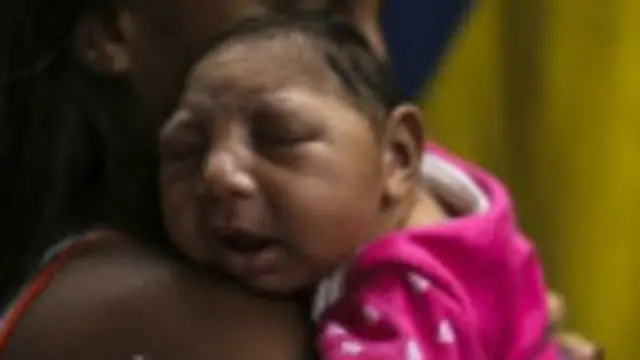 寨卡病毒能够导致新生儿的“小头症”（microcepaly）畸形