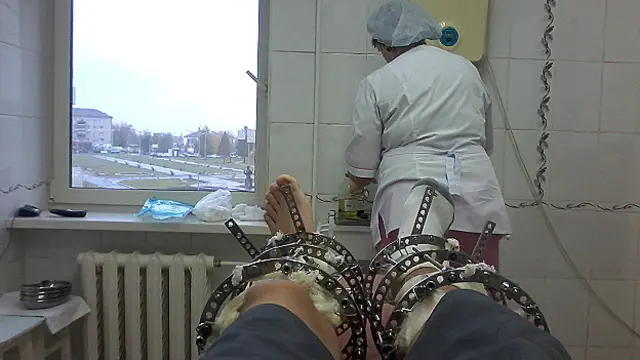 La intervención es dolorosa pero para gente como Esteban, merece la pena.