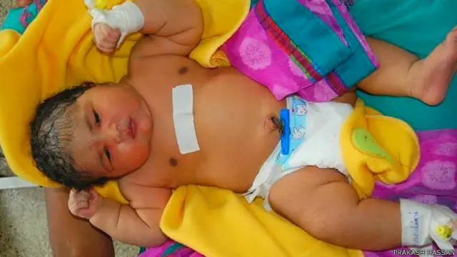 'सबसे वज़नदार शिशु'