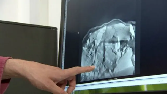 صورة مقربة لمسح الجمجمة.