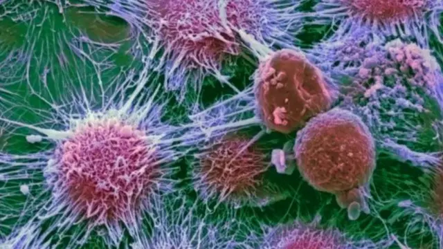 الأورام السرطانية تقلصت بنسبة 31 بالمئة عند استخدام علاجات دقيقة تستهدف الطفرات التي تساعد الورم على تطوير قدراته