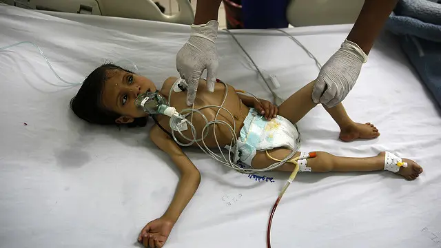 سنہ 2015 میں یمن میں مجمموعی طور پر 1953 بچے ہلاک ہوئے جن میں 60 فیصد بچوں کی ہلاکتوں کی وجہ سعودی اتحاد کے حملے بتائے گئے ہیں