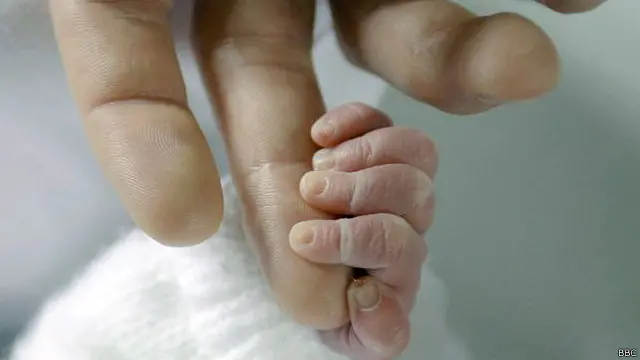 Ibunya dinyatakan mengalami mati otak pada 20 Februari lalu setelah mengalami pendarahan otak.