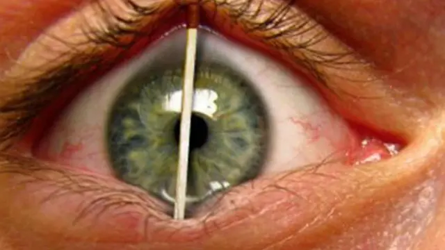 Спичка поддерживает веко