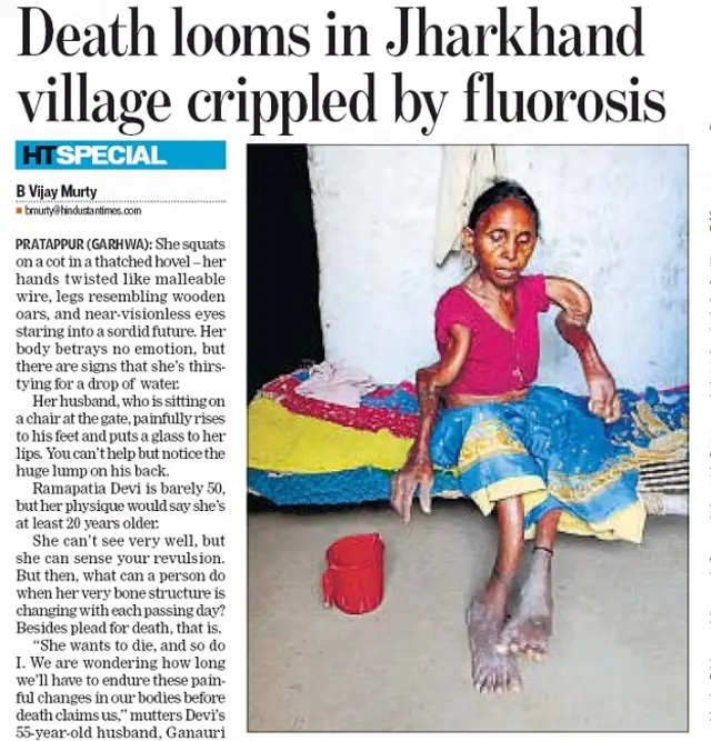 स्केलेटल फ्लोरोसिस