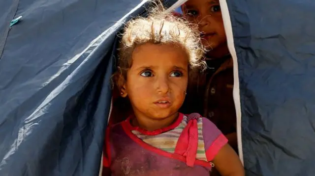 جنگ در یمن منجر به کشته شدن ۶٫۲۰۰ غیرنظامی و مجروح شدن دهها هزار یمنی شده و دو میلیون و چهارصد هزار نفر در نتیجه این جنگ آواره شدهاند