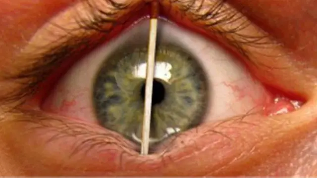 स्लीप कोच