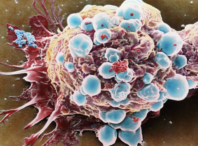 Клетки рака молочной железы