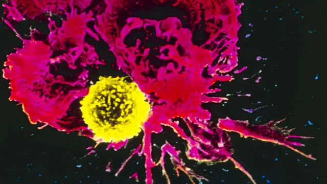 Раковые клетки часто приходится атаковать несколько раз