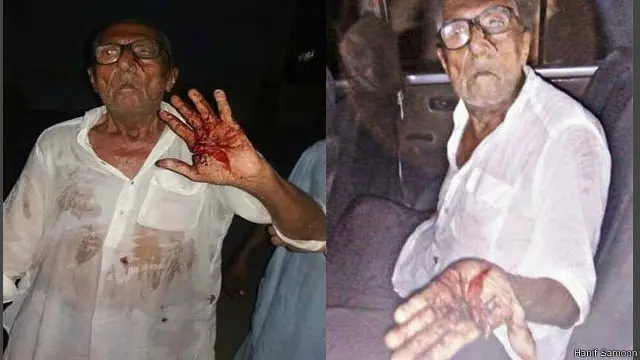 یہ تصویر حنیف سموں نے ارسال کی جس میں گوکل داس اپنے زخمی ہاتھ دکھا رہے ہیں