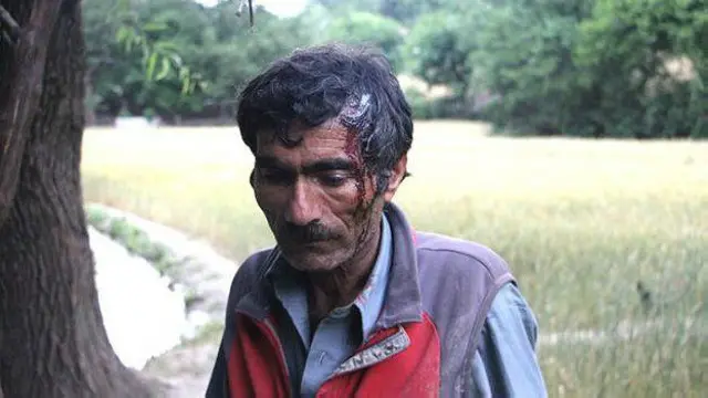 د کالاش فعالان وايي، د پنجشنبې ورځې په نښته کې ګڼ کسان ټپیان شول