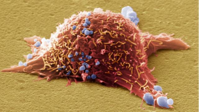 癌細胞生長速度很快，並迅速失控。(圖片來源: Science Photo Library )