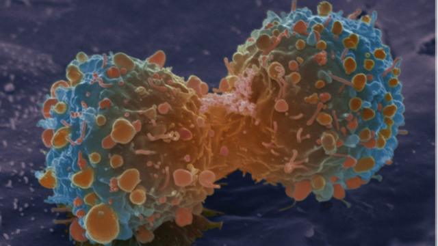  随着癌细胞变异，它们的基因也开始多样化(图片来源: Science Photo Library)